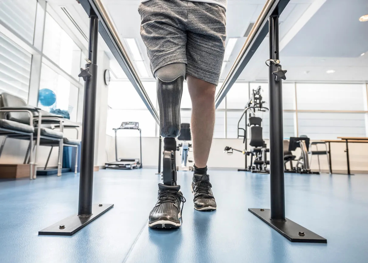 Man training himself on prosthetic leg
